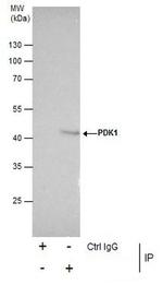 PDK1 Antibody in Immunoprecipitation (IP)