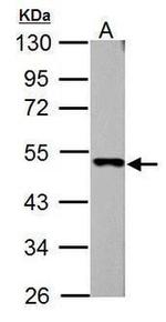 IP6K1 Antibody in Western Blot (WB)