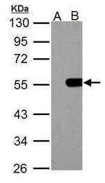 IP6K1 Antibody in Western Blot (WB)