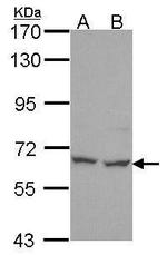 PNK Polyclonal Antibody