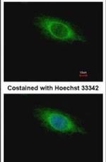 VPS34 Antibody in Immunocytochemistry (ICC/IF)