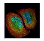 NFkB p65 Polyclonal Antibody