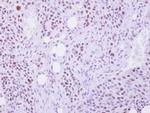 SEPHS1 Antibody in Immunohistochemistry (Paraffin) (IHC (P))