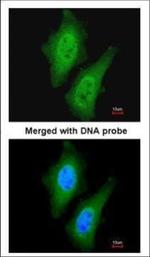 STKLD1 Polyclonal Antibody