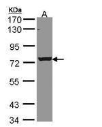 STKLD1 Antibody in Western Blot (WB)