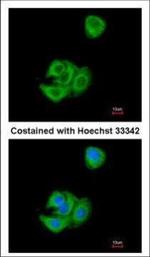 AGR3 Polyclonal Antibody