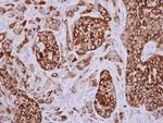 AGR3 Antibody in Immunohistochemistry (Paraffin) (IHC (P))