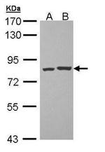 PKC theta Antibody in Western Blot (WB)