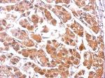PUMA alpha Polyclonal Antibody