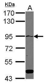 ATP2C1 Polyclonal Antibody
