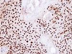 Ku80 Antibody in Immunohistochemistry (Paraffin) (IHC (P))