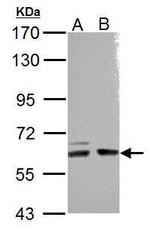 ARHGEF9 Antibody in Western Blot (WB)
