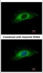 Cytokeratin 7 Polyclonal Antibody