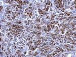 Cytokeratin 7 Antibody in Immunohistochemistry (Paraffin) (IHC (P))