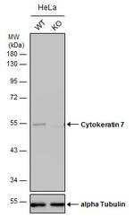 Cytokeratin 7 Antibody in Western Blot (WB)