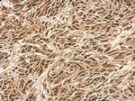 SUMO1 Antibody in Immunohistochemistry (Paraffin) (IHC (P))