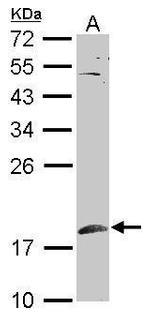 SUMO1 Antibody in Western Blot (WB)