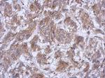ATG16L1 Polyclonal Antibody