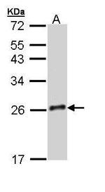 GH2 Antibody in Western Blot (WB)