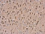 HSP70 Antibody in Immunohistochemistry (Paraffin) (IHC (P))