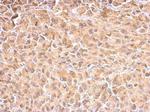 HSP70 Antibody in Immunohistochemistry (Paraffin) (IHC (P))