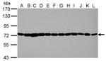 HSP70 Antibody in Western Blot (WB)