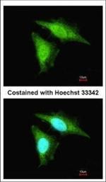 SMAD3 Polyclonal Antibody