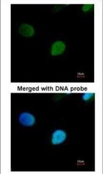 PRP19 Antibody in Immunocytochemistry (ICC/IF)