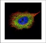 SQSTM1 Polyclonal Antibody