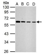 SQSTM1 Antibody in Western Blot (WB)