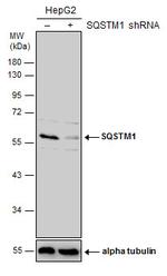 SQSTM1 Antibody in Western Blot (WB)