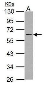 ABI1 Antibody in Western Blot (WB)