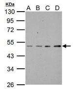 ABI1 Polyclonal Antibody