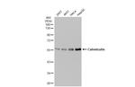Calreticulin Antibody in Western Blot (WB)