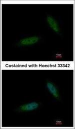 TBCK Polyclonal Antibody