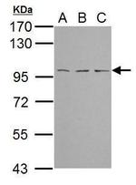 TBCK Antibody in Western Blot (WB)