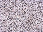 TIP60 Antibody in Immunohistochemistry (Paraffin) (IHC (P))