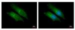 Bcl-10 Polyclonal Antibody
