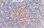 PARP1 Antibody in Immunohistochemistry (Paraffin) (IHC (P))
