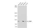 PARP1 Antibody in Western Blot (WB)