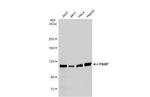PARP1 Antibody in Western Blot (WB)