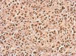 p21 Antibody in Immunohistochemistry (Paraffin) (IHC (P))