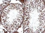 TBK1 Antibody in Immunohistochemistry (Paraffin) (IHC (P))