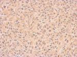 COX1 Polyclonal Antibody