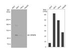 STAT6 Antibody in Western Blot (WB)