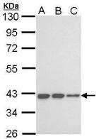 KIR3DL2 Antibody in Western Blot (WB)