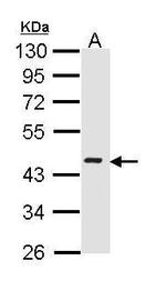ICAD Polyclonal Antibody