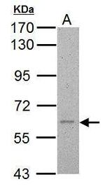 Calcium Channel beta-4 Polyclonal Antibody