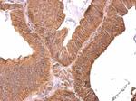 ROBO1 Polyclonal Antibody