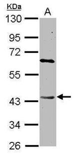DAPK2 Antibody in Western Blot (WB)